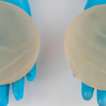 Implants mammaires : le droit à l’information toujours aussi déficient