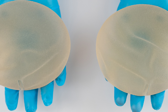 Implants mammaires : le droit à l’information toujours aussi déficient